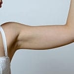 Tone the arms and address sagging skin with an arm lift